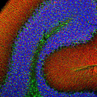 Immunofluorescence of rat cerebellum showing specific alpha-synuclein staining in synaptic regions in red and GFAP (cat. 620-GFAP) in the cytoskeleton of glia and astrocytes in green. DNA is stained blue.