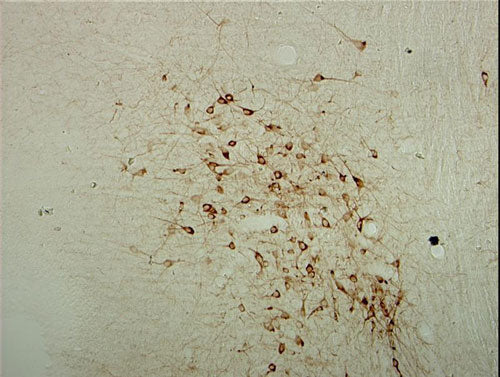 Immunostaining of rat brainstem showing specific labeling using our anti-ChAT antibody. Image courtesy of Dr. Robert Sloviter, University of Arizona.