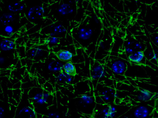 Immunochemical staining of saline treated mouse cortex cryosections showing specific labeling of CNP(cat. 325-CNP, green, 1:500). The blue is staining DNA. The bisected longitudinal mouse brain was fixed for 18h in 4% paraformaldehyde, washed, and cryoprotected in 30% sucrose overnight. The cryosections were antigen retrieved in citrate buffer, blocked in 20% normal goat serum for 1 hr. Photo courtesy of Robert Wine.