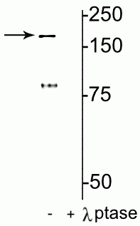 Western blot of rat hippocampal lysate showing specific immunolabeling of the ~180 kDa NR2B subunit of the NMDAR phosphorylated at Tyr1472 in the first lane (-). Phosphospecificity is shown in the second lane (+) where immunolabeling is completely eliminated by lysate treatment with lambda phosphatase (400 units/100uL lysate for 30 min). 