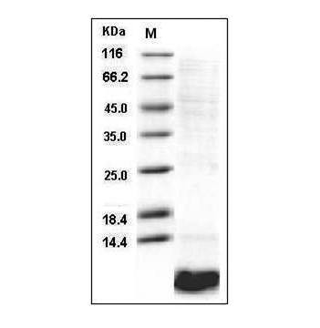 Fig.SDS-PAGE analysis of Human EGF protein.