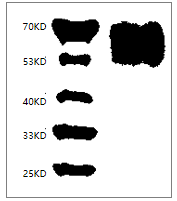 Fig. SDS-PAGE analysis of Human CD86/B7-2 protein, His tag.