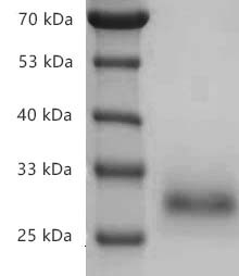 Fig.SDS-PAGE analysis of Human CD40/TNFRSF5 protein, His tag