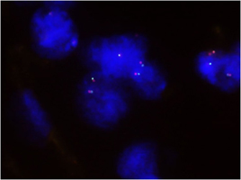 Fluorescent <i>In Situ</i> Hybridization (Formalin/PFA-fixed paraffin-embedded sections) 