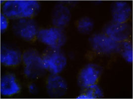 Fluorescent <i>In Situ</i> Hybridization (Formalin/PFA-fixed paraffin-embedded sections) 