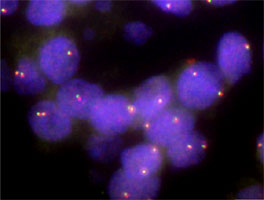 Fluorescent <i>In Situ</i> Hybridization (Formalin/PFA-fixed paraffin-embedded sections) 