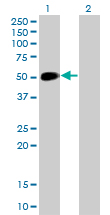 Western Blot (Transfected lysate)