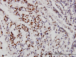 Immunohistochemistry (Formalin/PFA-fixed paraffin-embedded sections)