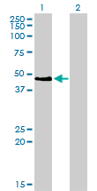 Western Blot (Transfected lysate)