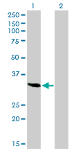 Western Blot (Transfected lysate)