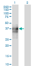 Western Blot (Transfected lysate)