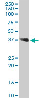 Western Blot (Tissue lysate)