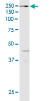 Western Blot (Cell lysate)