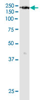 Western Blot (Cell lysate)