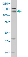 Western Blot (Cell lysate)