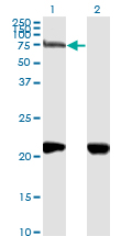 Western Blot (Transfected lysate)