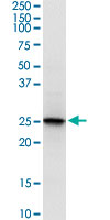 Western Blot (Cell lysate)