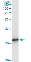 Western Blot (Tissue lysate)