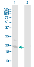 Western Blot (Transfected lysate)