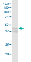 Western Blot (Tissue lysate)