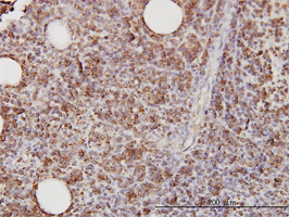 Immunohistochemistry (Formalin/PFA-fixed paraffin-embedded sections)