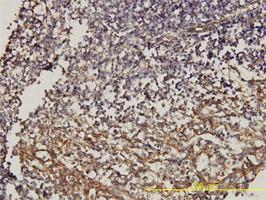 Immunohistochemistry (Formalin/PFA-fixed paraffin-embedded sections)