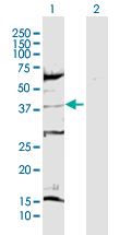 Western Blot (Transfected lysate)