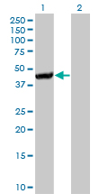 Western Blot (Transfected lysate)