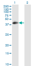 Western Blot (Transfected lysate)