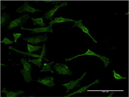 Immunofluorescence