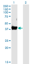 Western Blot (Transfected lysate)