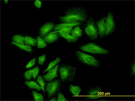 Immunofluorescence