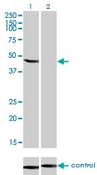 RNAi Knockdown (Antibody validated)