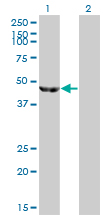 Western Blot (Transfected lysate)