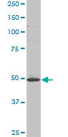 Western Blot (Cell lysate)