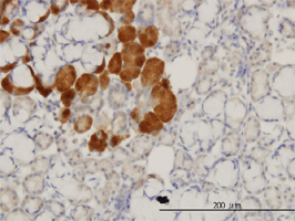 Immunohistochemistry (Formalin/PFA-fixed paraffin-embedded sections)