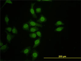 Immunofluorescence