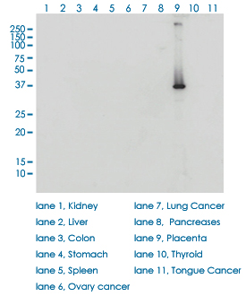 Western Blot (Cell lysate)