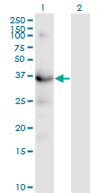 Western Blot (Transfected lysate)