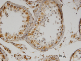 Immunohistochemistry (Formalin/PFA-fixed paraffin-embedded sections)