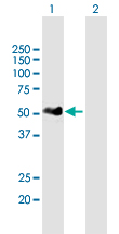 Western Blot (Transfected lysate)