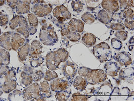 Immunohistochemistry (Formalin/PFA-fixed paraffin-embedded sections)