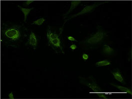 Immunofluorescence