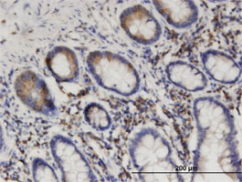 Immunohistochemistry (Formalin/PFA-fixed paraffin-embedded sections)