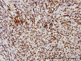 Immunohistochemistry (Formalin/PFA-fixed paraffin-embedded sections)