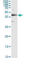 Immunoprecipitation