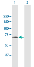 Western Blot (Transfected lysate)