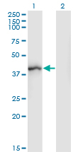 Western Blot (Transfected lysate)