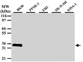 Western Blot (Cell lysate)