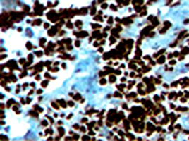 Immunohistochemistry (Formalin/PFA-fixed paraffin-embedded sections)